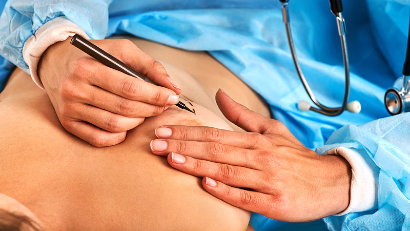 Ästhetik Centrum Bochum: Plastische und ästhetische Chirurgie auf höchstem Niveau